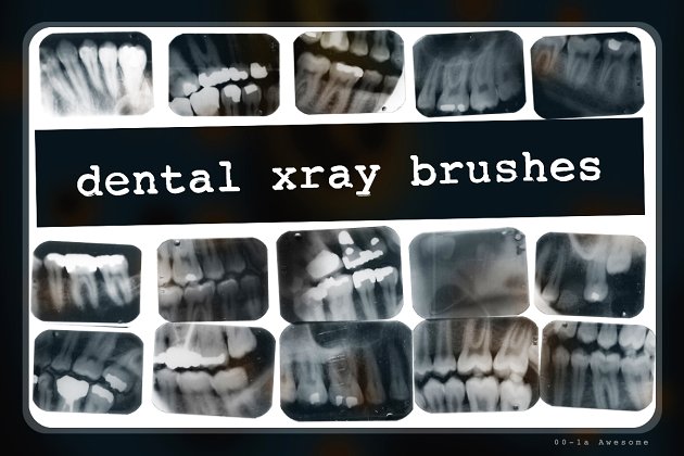 骨骼骨头的X光片特效笔刷 Dental X-ray Brushes